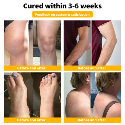 Only 5-6 boxes left! We are offering you an additional 30% off! Orthopedic surgeons recommend 4-5 boxes to restore your joints to health! If you miss this opportunity, you'll have to wait until next year! 👩‍🔬